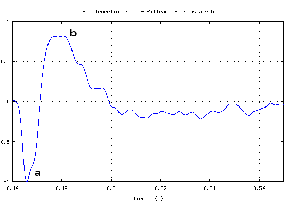 electrocardiograma