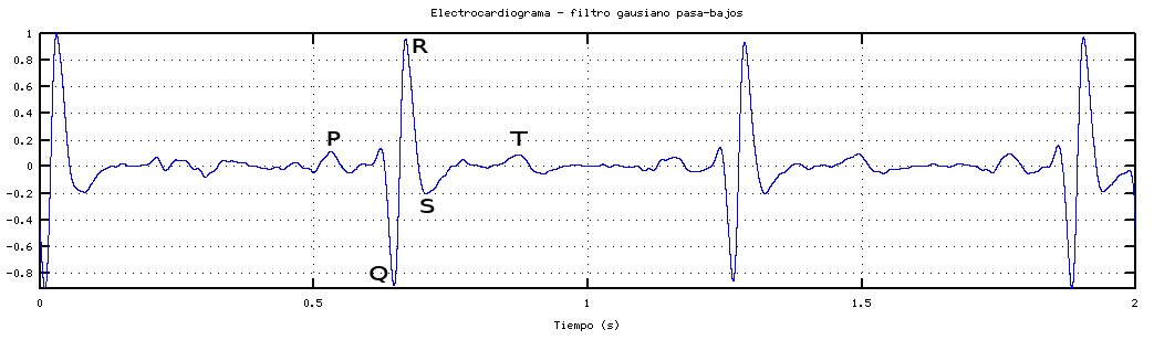 electrocardiograma